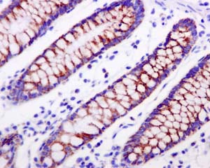 Immunohistochemistry (Formalin/PFA-fixed paraffin-embedded sections) - Anti-PDHA1 (phospho S293) antibody [EPR12200] - BSA and Azide free (AB227565)