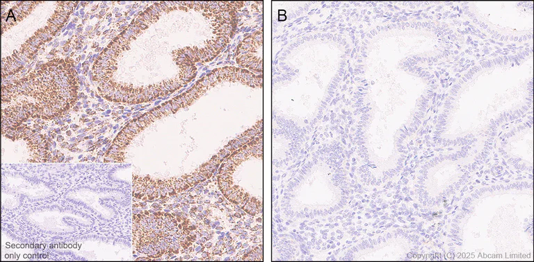 Immunohistochemistry (Formalin/PFA-fixed paraffin-embedded sections) - Anti-PDHA1 (phospho S300) antibody [EPR29824-87] (AB324265)