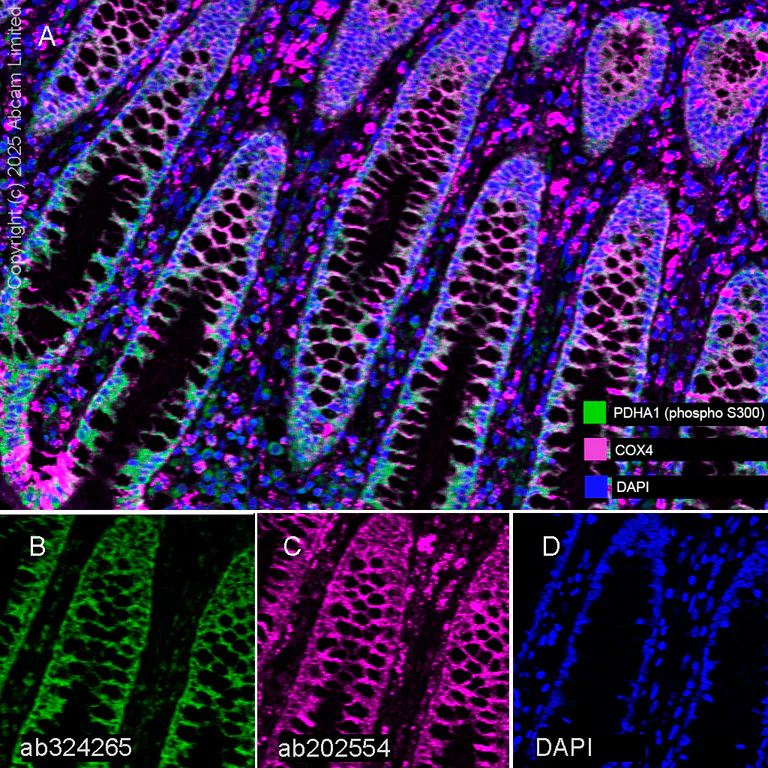 Multiplex immunohistochemistry - Anti-PDHA1 (phospho S300) antibody [EPR29824-87] (AB324265)