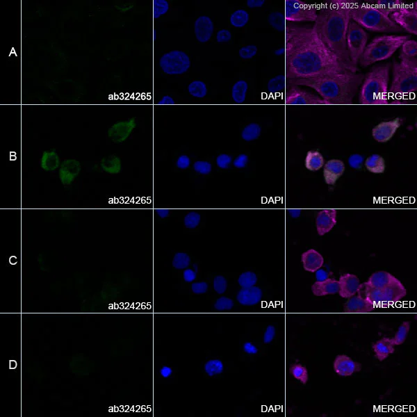 Immunocytochemistry/ Immunofluorescence - Anti-PDHA1 (phospho S300) antibody [EPR29824-87] - BSA and Azide free (AB324275)