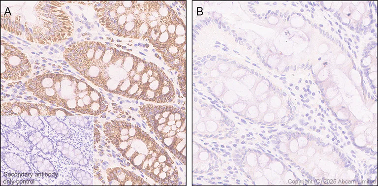 Immunohistochemistry (Formalin/PFA-fixed paraffin-embedded sections) - Anti-PDHA1 (phospho S300) antibody [EPR29824-87] - BSA and Azide free (AB324275)