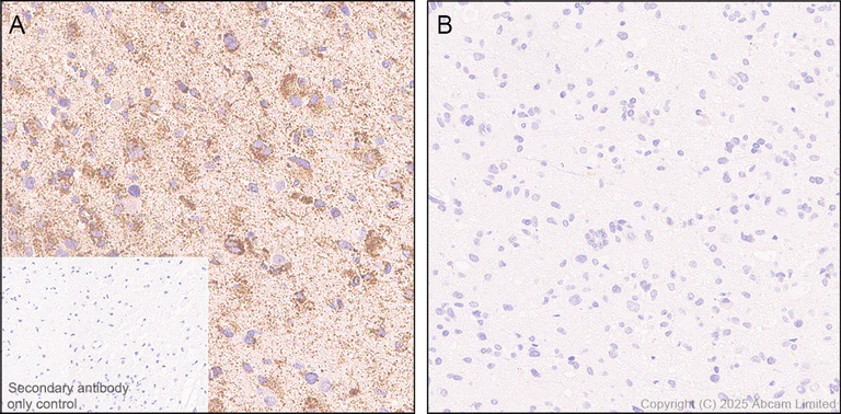 Immunohistochemistry (Formalin/PFA-fixed paraffin-embedded sections) - Anti-PDHA1 (phospho S300) antibody [EPR29824-87] - BSA and Azide free (AB324275)