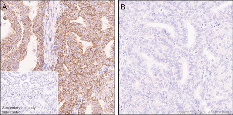 Immunohistochemistry (Formalin/PFA-fixed paraffin-embedded sections) - Anti-PDHA1 (phospho S300) antibody [EPR29824-87] - BSA and Azide free (AB324275)
