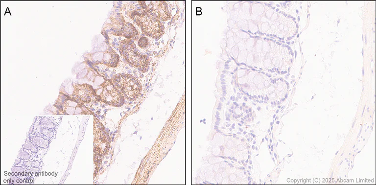 Immunohistochemistry (Formalin/PFA-fixed paraffin-embedded sections) - Anti-PDHA1 (phospho S300) antibody [EPR29824-87] - BSA and Azide free (AB324275)