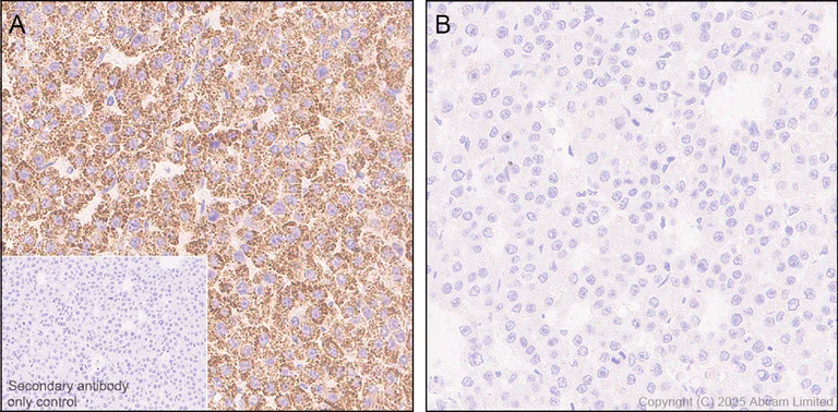 Immunohistochemistry (Formalin/PFA-fixed paraffin-embedded sections) - Anti-PDHA1 (phospho S300) antibody [EPR29824-87] - BSA and Azide free (AB324275)