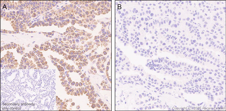 Immunohistochemistry (Formalin/PFA-fixed paraffin-embedded sections) - Anti-PDHA1 (phospho S300) antibody [EPR29824-87] - BSA and Azide free (AB324275)