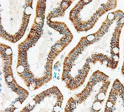 Immunohistochemistry (Formalin/PFA-fixed paraffin-embedded sections) - Anti-PDHB antibody [17A5E2H8] (AB110331)