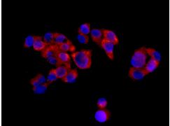 Immunocytochemistry/ Immunofluorescence - Anti-PDHB antibody [EPR11096(B)] (AB155953)