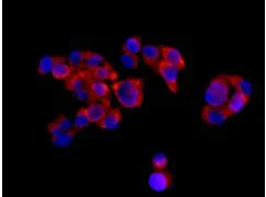 Immunocytochemistry/ Immunofluorescence - Anti-PDHB antibody [EPR11096(B)] (AB155953)