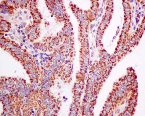 Immunohistochemistry (Formalin/PFA-fixed paraffin-embedded sections) - Anti-PDHB antibody [EPR11096(B)] - BSA and Azide free (AB249208)