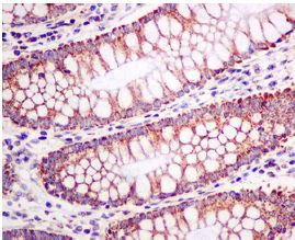 Immunohistochemistry (Formalin/PFA-fixed paraffin-embedded sections) - Anti-PDHB antibody [EPR11096(B)] - BSA and Azide free (AB249208)