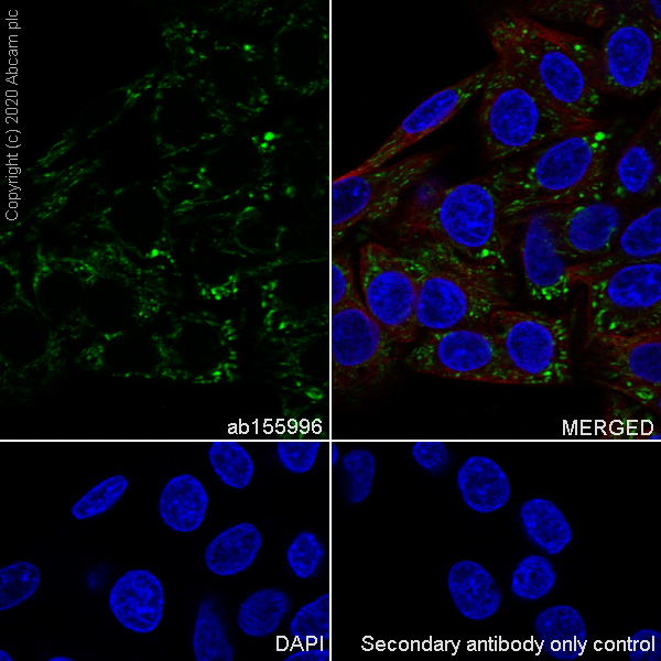 Immunocytochemistry/ Immunofluorescence - Anti-PDHB antibody [EPR11097(B)] (AB155996), expandable thumbnail