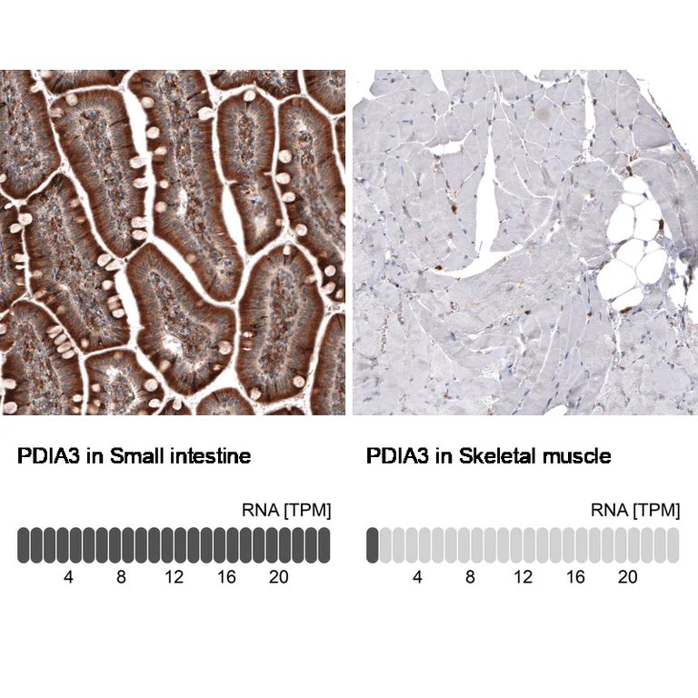 Immunohistochemistry (Formalin/PFA-fixed paraffin-embedded sections) - Anti-PDIA3 Antibody [CL2446] (AB327107)