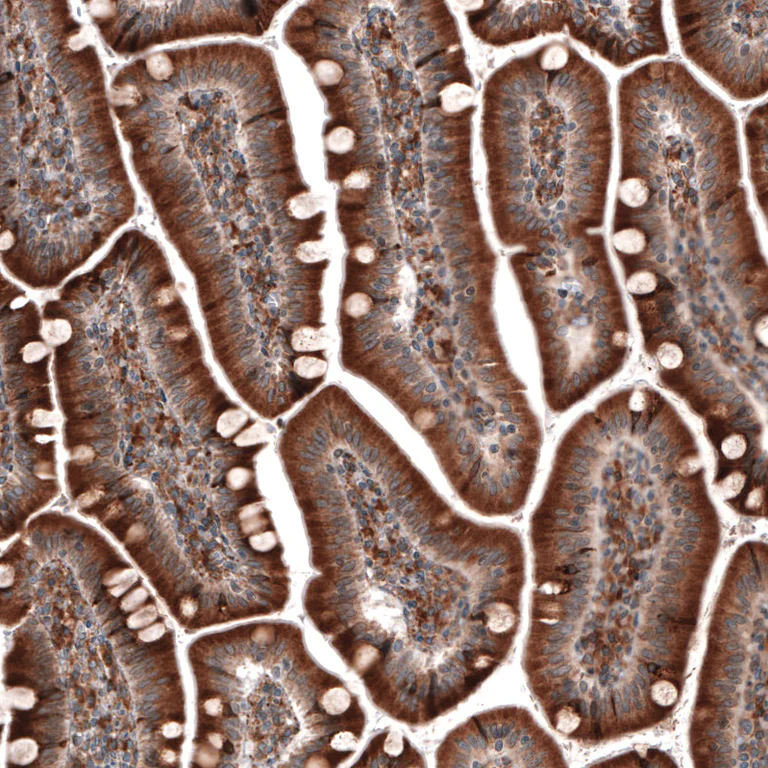 Immunohistochemistry (Formalin/PFA-fixed paraffin-embedded sections) - Anti-PDIA3 Antibody [CL2446] (AB327107)