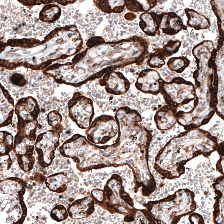 Immunohistochemistry (Formalin/PFA-fixed paraffin-embedded sections) - Anti-PDIA3 Antibody [CL2446] (AB327107)