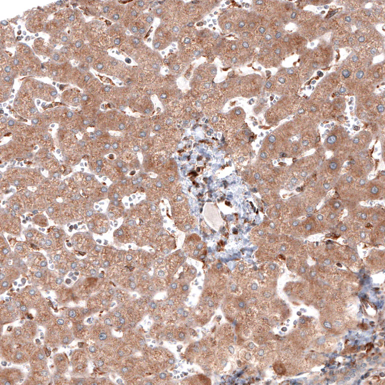 Immunohistochemistry (Formalin/PFA-fixed paraffin-embedded sections) - Anti-PDIA3 Antibody [CL2446] (AB327107)