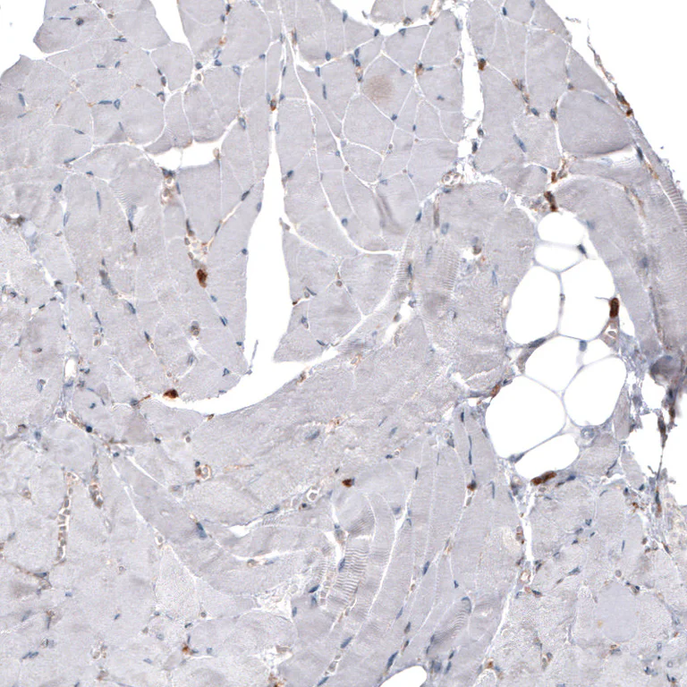 Immunohistochemistry (Formalin/PFA-fixed paraffin-embedded sections) - Anti-PDIA3 Antibody [CL2446] (AB327107)