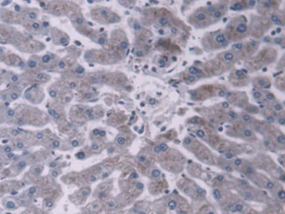Immunohistochemistry (Formalin/PFA-fixed paraffin-embedded sections) - Anti-PDIA5 antibody (AB232979)