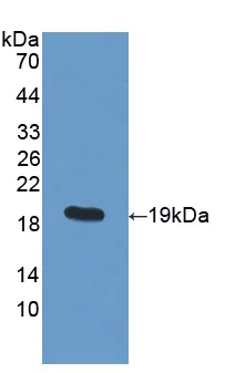 Western blot - Anti-PDIA5 antibody (AB232979)