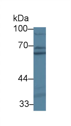 Western blot - Anti-PDIA5 antibody (AB232979)