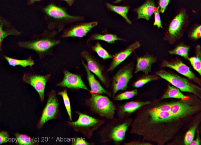 Immunocytochemistry/ Immunofluorescence - Anti-PDIA6 antibody (AB11432)