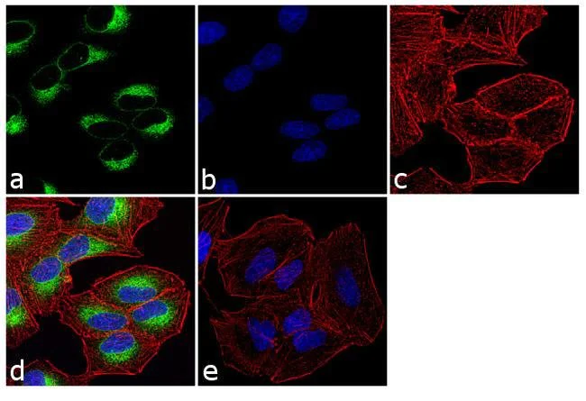 Immunocytochemistry/ Immunofluorescence - Anti-PDIA6 antibody (AB11432)