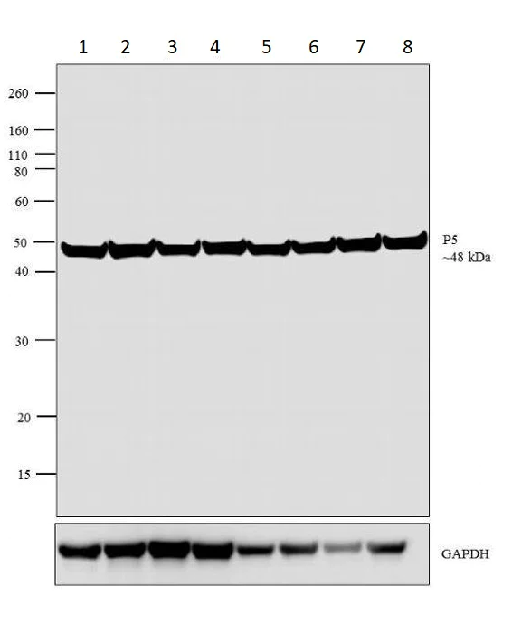 Western blot - Anti-PDIA6 antibody (AB11432)