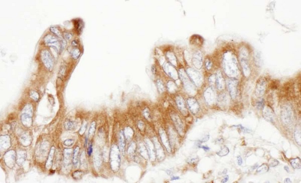 Immunohistochemistry (Formalin/PFA-fixed paraffin-embedded sections) - Anti-PDIA6 antibody (AB225993)