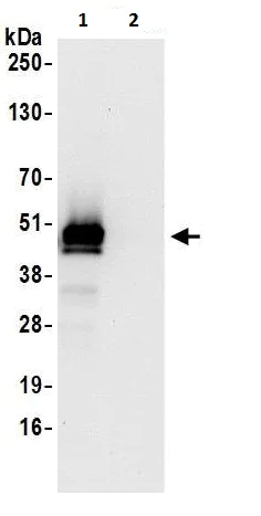 Immunoprecipitation - Anti-PDIA6 antibody (AB225993)