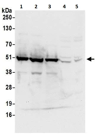 Western blot - Anti-PDIA6 antibody (AB225993)