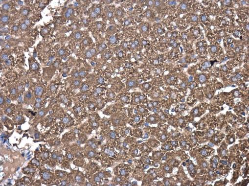 Immunohistochemistry (Formalin/PFA-fixed paraffin-embedded sections) - Anti-PDIA6 antibody (AB227545)