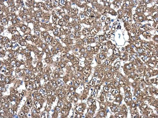 Immunohistochemistry (Formalin/PFA-fixed paraffin-embedded sections) - Anti-PDIA6 antibody (AB227545)