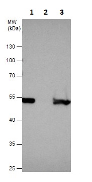 Immunoprecipitation - Anti-PDIA6 antibody (AB227545)