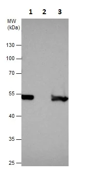 Immunoprecipitation - Anti-PDIA6 antibody (AB227545)