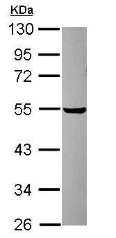 Western blot - Anti-PDIA6 antibody (AB227545)