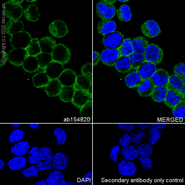 Immunocytochemistry/ Immunofluorescence - Anti-PDIA6 antibody [EPR10132(B)] (AB154820)