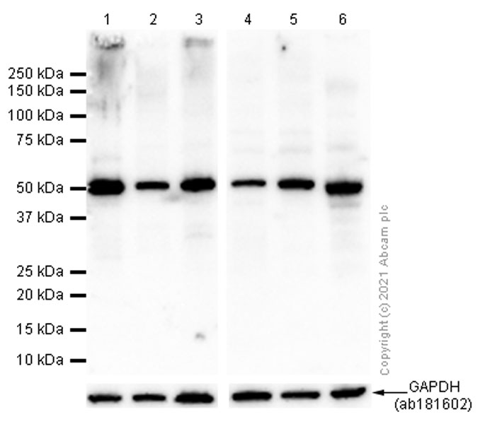 Anti-PDIA6 antibody [EPR10132(B)]