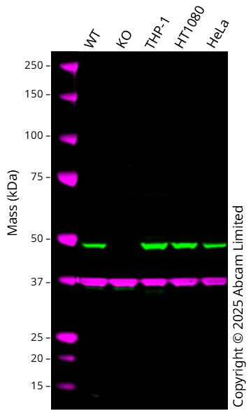 Western blot - Anti-PDIA6 antibody [EPR10132(B)] (AB154820)