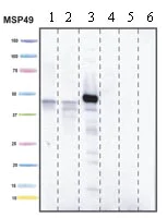 Western blot - Anti-PDK1 antibody [2H3AA11] (AB110335)
