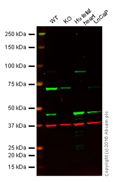 Western blot - Anti-PDK1 antibody [2H3AA11] (AB110335)