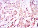 Immunohistochemistry (Formalin/PFA-fixed paraffin-embedded sections) - Anti-PDK1 antibody [4A11] (AB110025)