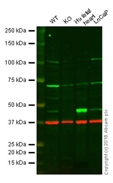 Western blot - Anti-PDK1 antibody [EPR13009] (AB175190), expandable thumbnail