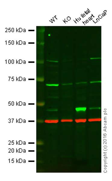 Western blot - Anti-PDK1 antibody [EPR13009] (AB175190)