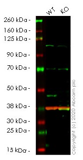 Western blot - Anti-PDK1 antibody [EPR13009] (AB175190), expandable thumbnail
