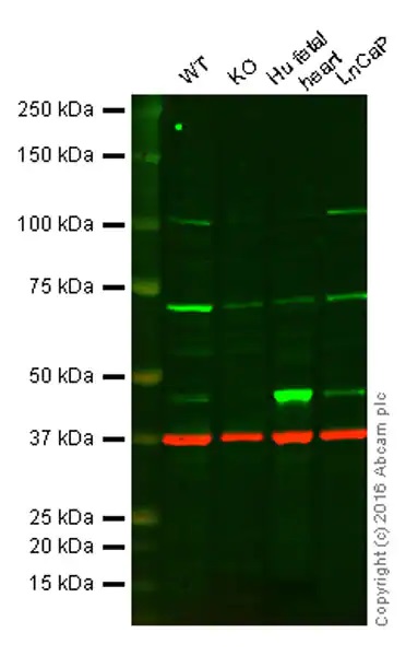 Western blot - Anti-PDK1 antibody [EPR13009] - BSA and Azide free (AB249846), expandable thumbnail