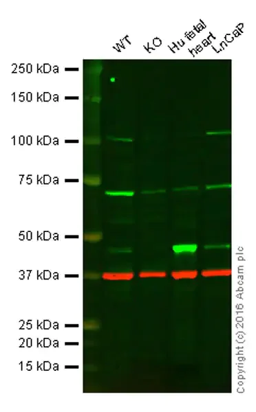 Western blot - Anti-PDK1 antibody [EPR13009] - BSA and Azide free (AB249846)