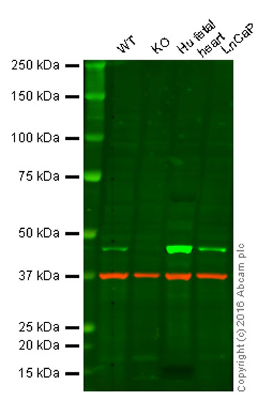 Western blot - Anti-PDK1 antibody [EPR13015] - C-terminal (AB180171), expandable thumbnail