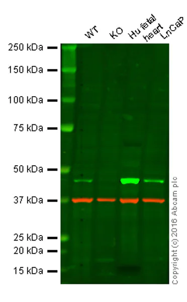 Western blot - Anti-PDK1 antibody [EPR13015] - C-terminal (AB180171)
