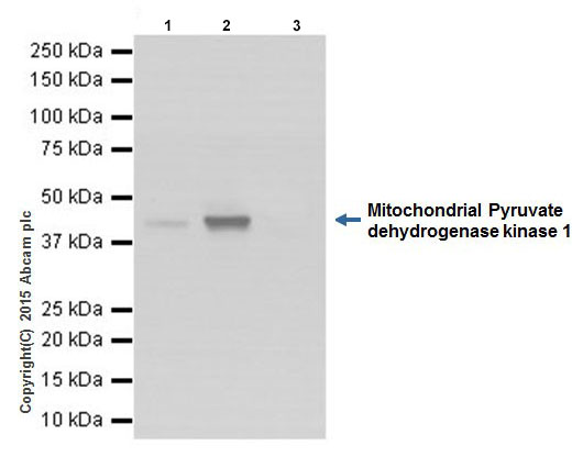 Immunoprecipitation - Anti-PDK1 antibody [EPR19571] (AB202468), expandable thumbnail