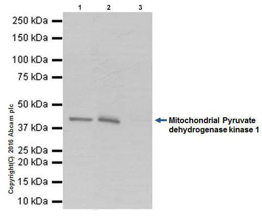 Immunoprecipitation - Anti-PDK1 antibody [EPR19573] (AB207450)